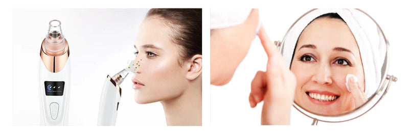 PureSkin – Removedor de Cravos com Sucção Profunda