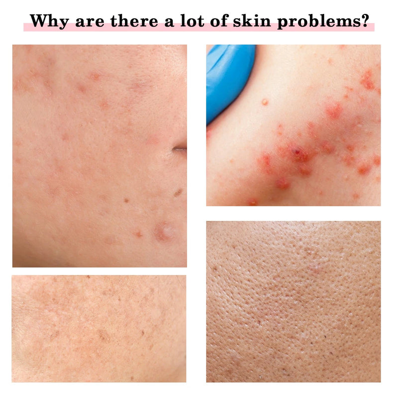 Massageador Facial PRO