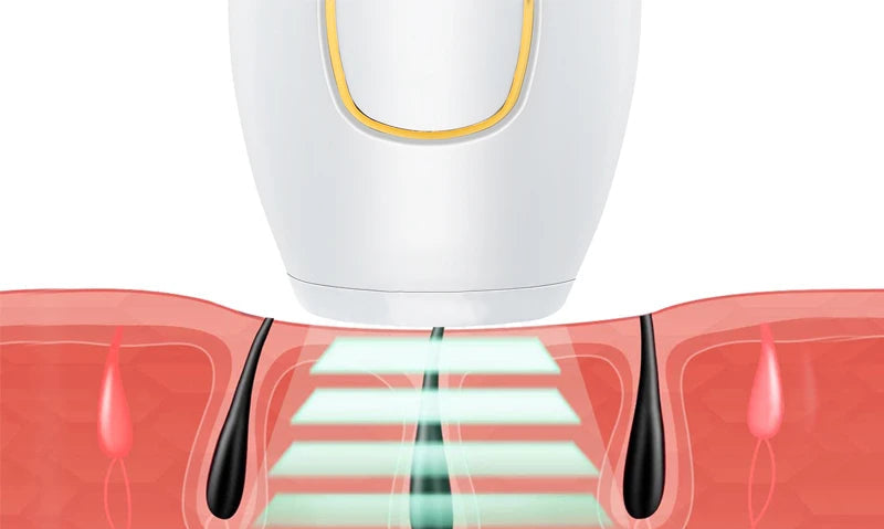 Depilador Insta Free Laser + BRINDE EXCLUSIVO!